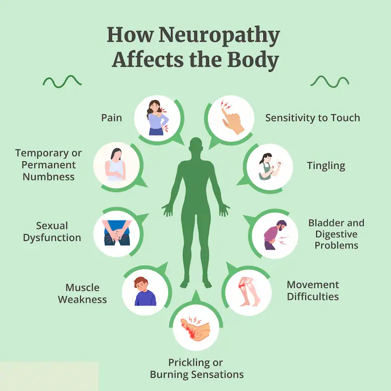 What is Neuropathy